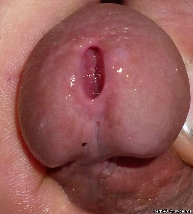 peehole