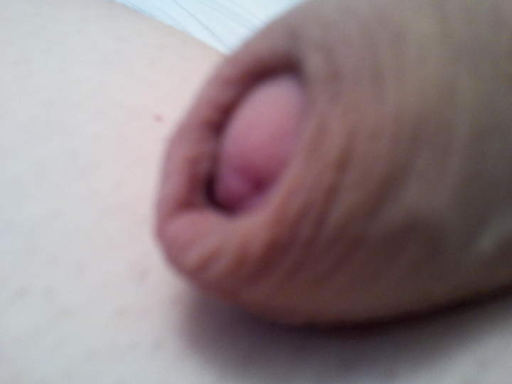 Photo of a private part from robbyboi