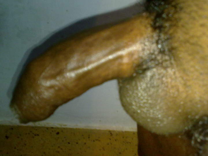 Photo of a one-eyed monster from sexbaba2111