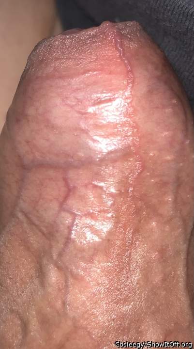 Photo of a prick from CBSLEEGY