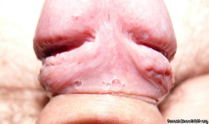 My frenulum...