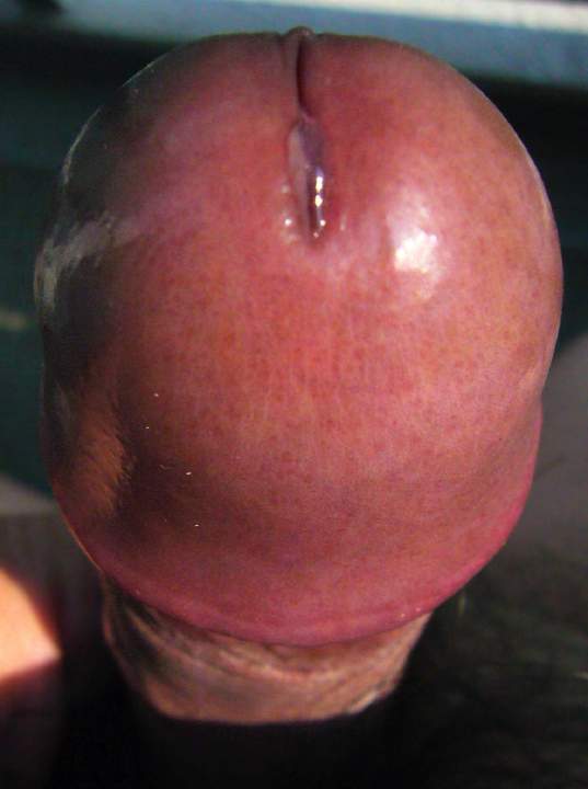 Nikuanzu (&#32905;&#26447;)