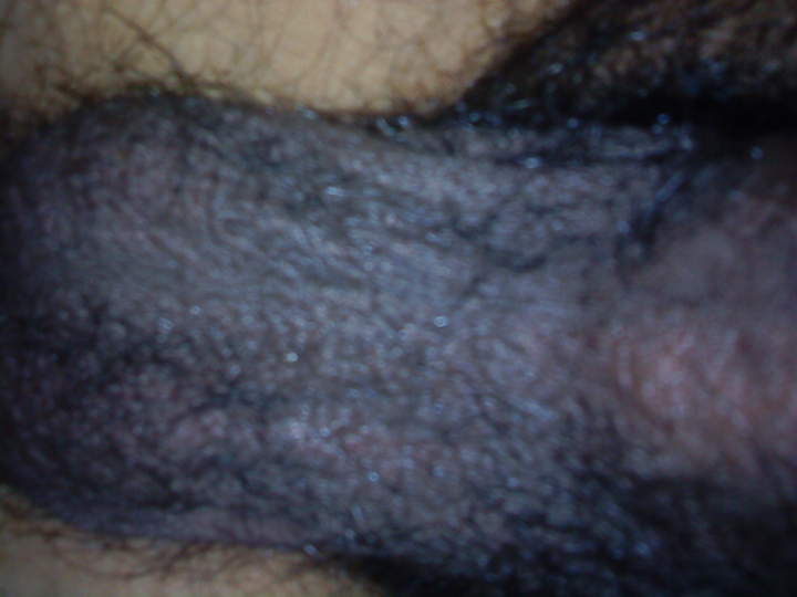Testicles Photo from nicedices