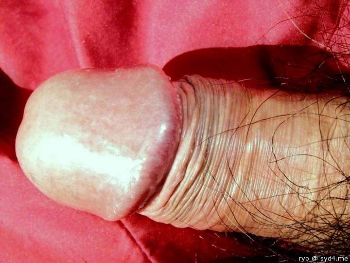 Photo of a wiener from ryo