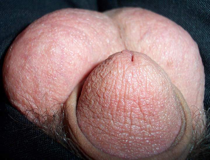 Photo of a phallus from lilsoftee