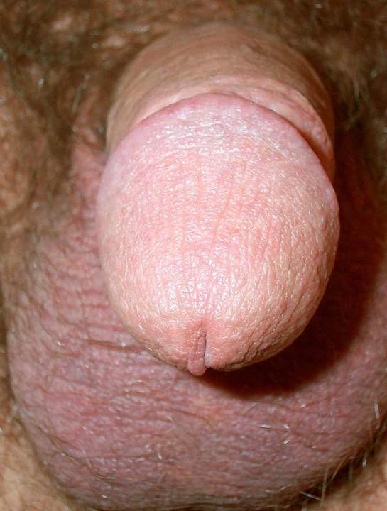 Photo of a phallus from lilsoftee