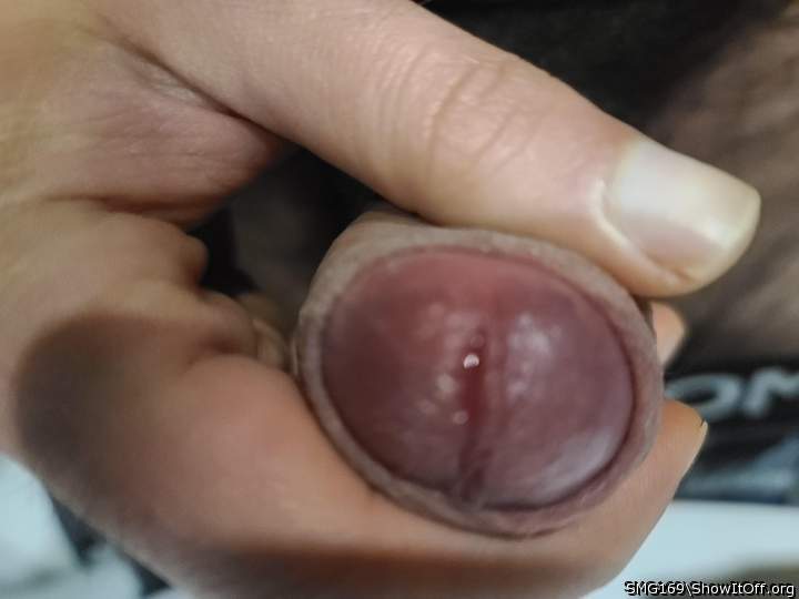 Photo of a middle leg from SMG169