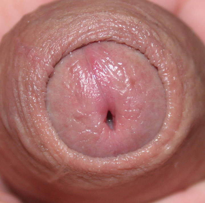 Photo of a private part from nylonlover