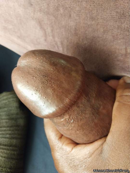 Photo of a short leg from Saddam