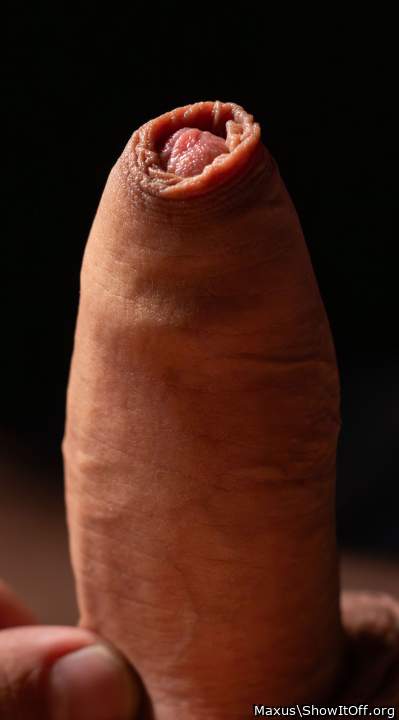 Foreskin Drama