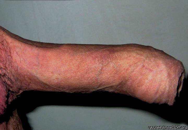 Photo of a penis from razzle4