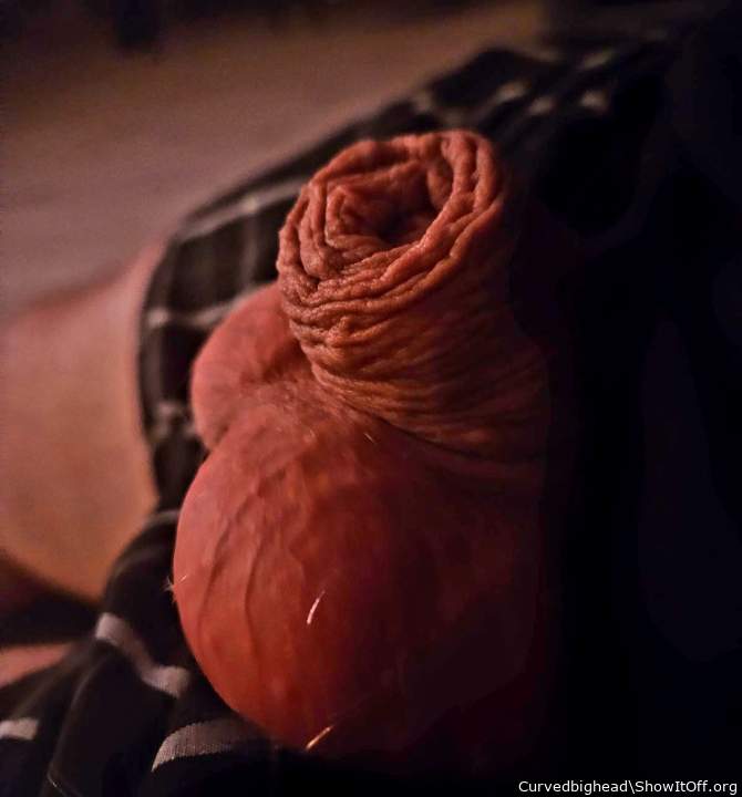 Photo of a short leg from Curvedbighead