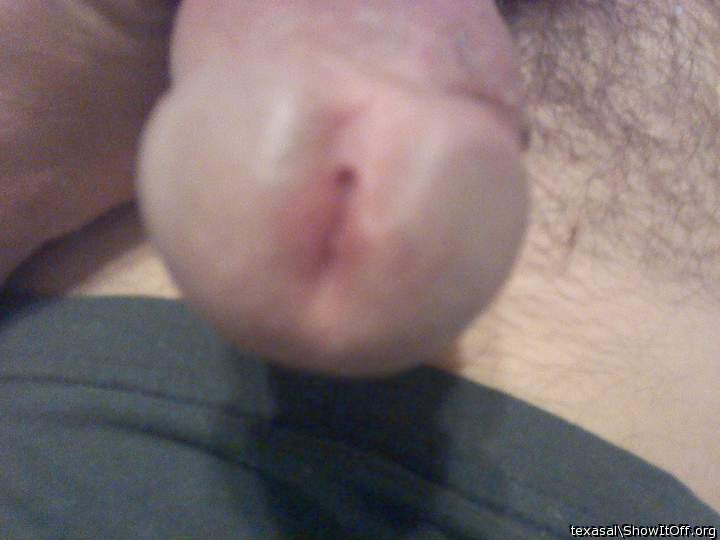 Photo of a short leg from texasal