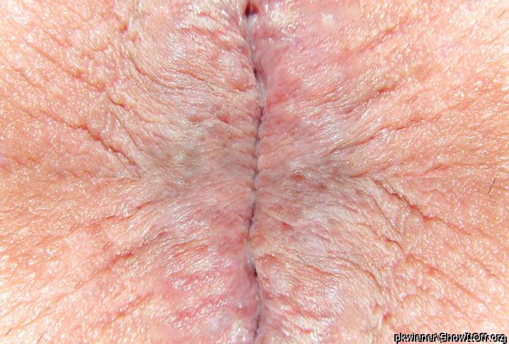 Photo of Man's Ass from pkwiener
