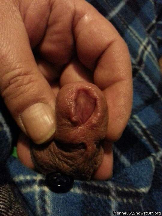 Second meatotomy cut