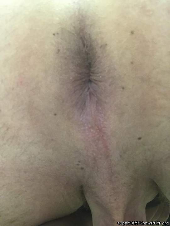 beautiful anal ring