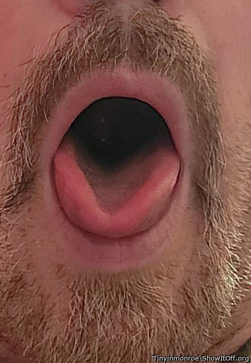 Photo of a penile from Tinyinmonroe