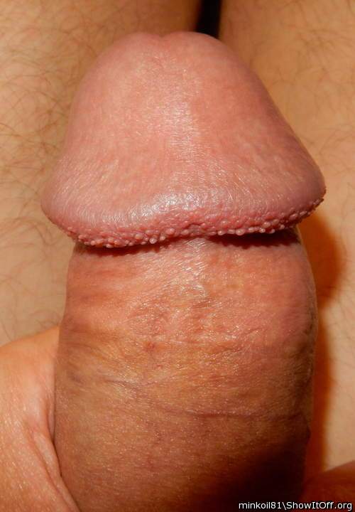 Cockhead