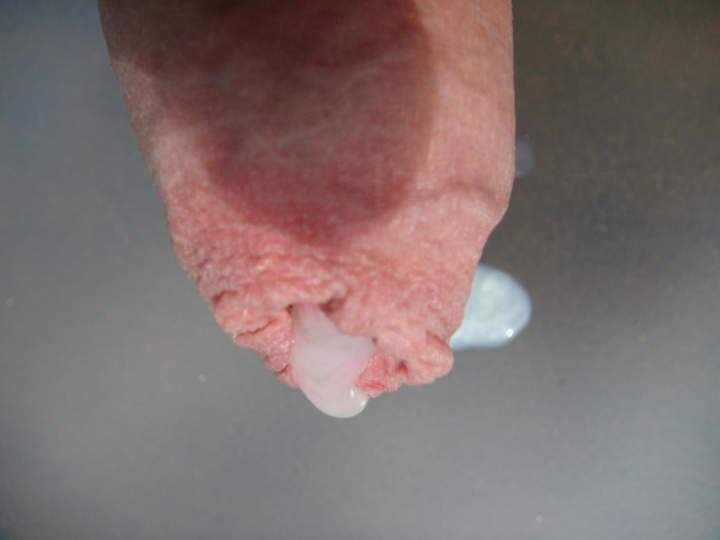 Photo of a middle leg from sivad666