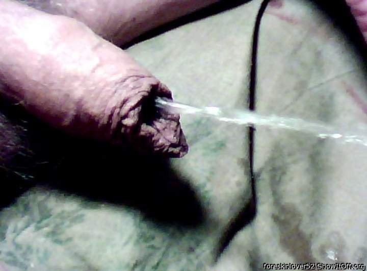 Photo of a purple headed monster from foreskinlover52