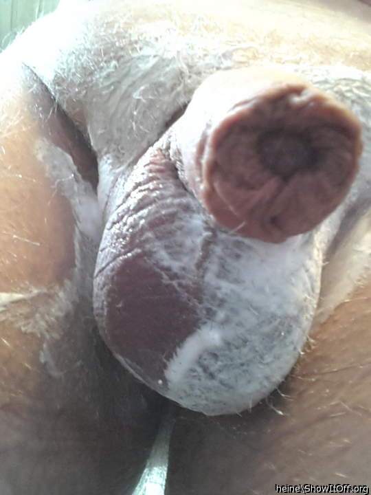 Photo of a penile from heine