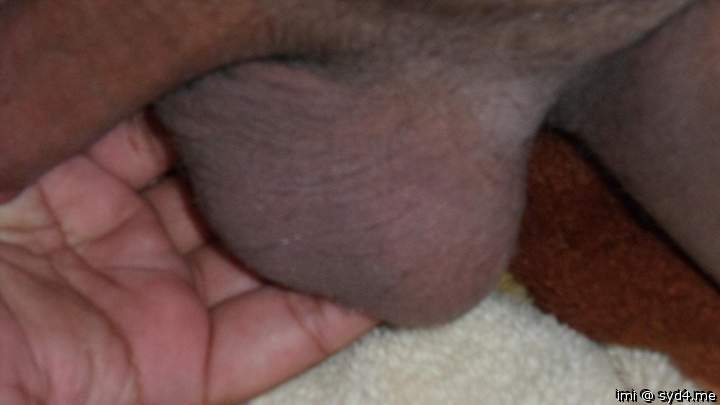Testicles Photo from imi