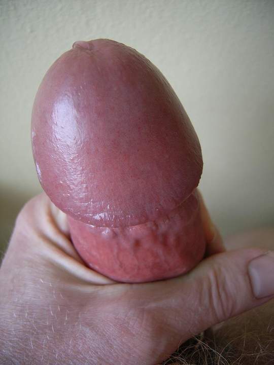 Adult image from greenbelt