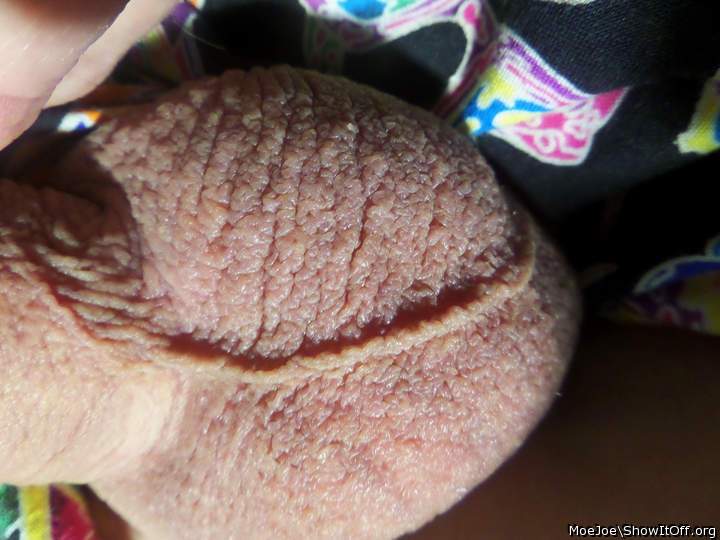 Scrotal Seam