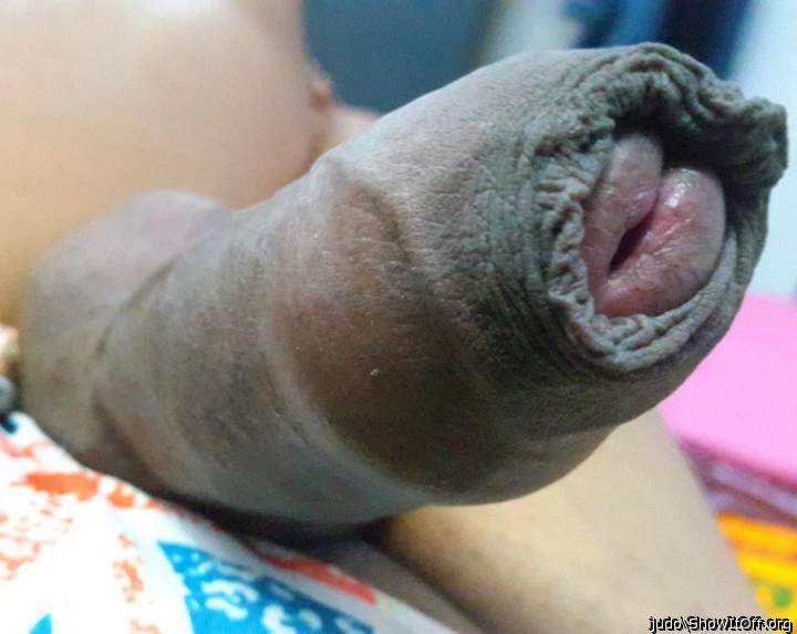    pretty foreskin ... compliment   & vote !!