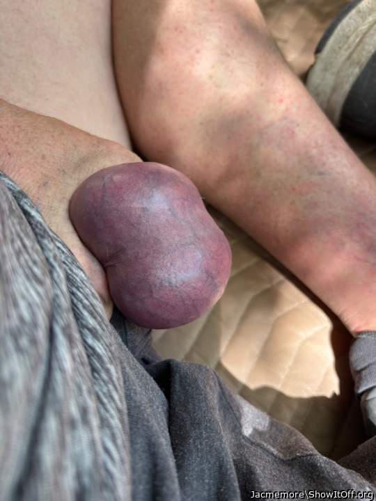 Testicles Photo from Jacmemore