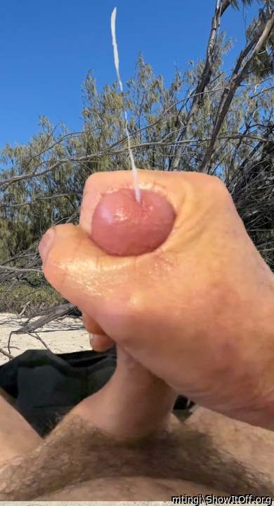 Photo of a wiener from mtingi