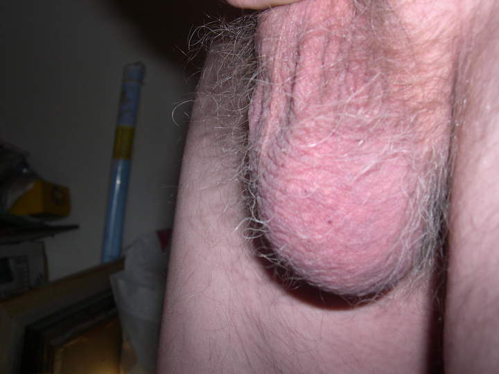 Great hairy balls 