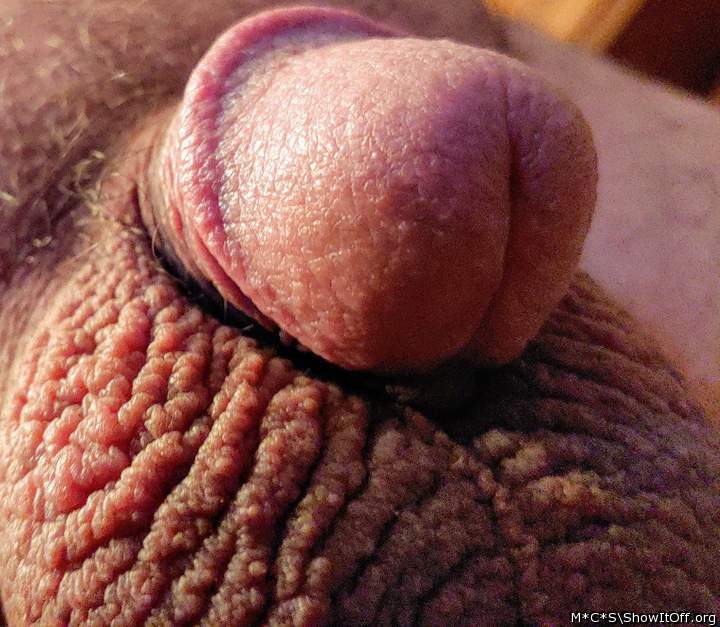 Photo of a penis from M*C*S