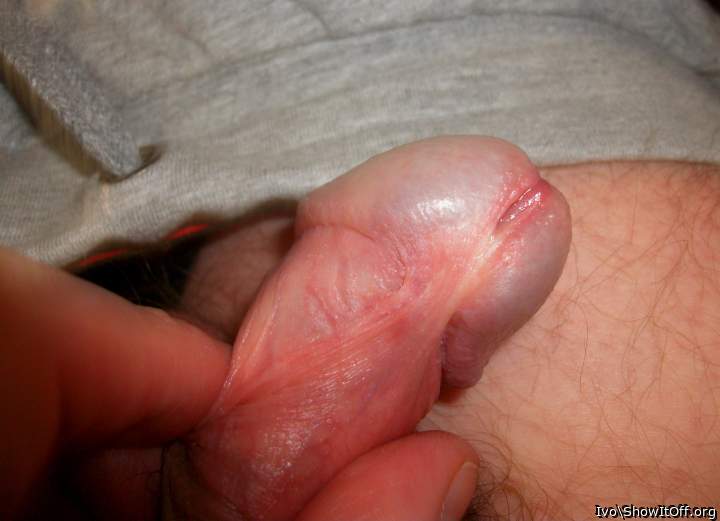 Nude glans (extreme closeup)