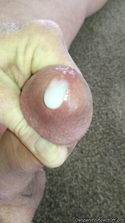 Photo of a private part from Denpenn