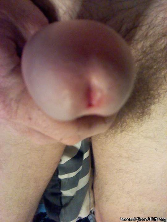 Photo of a private part from texasal