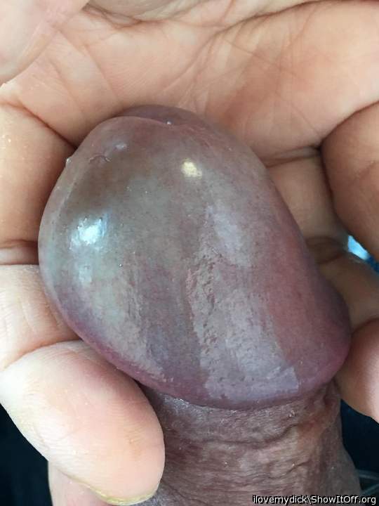 Photo of a penile from ilovemydick