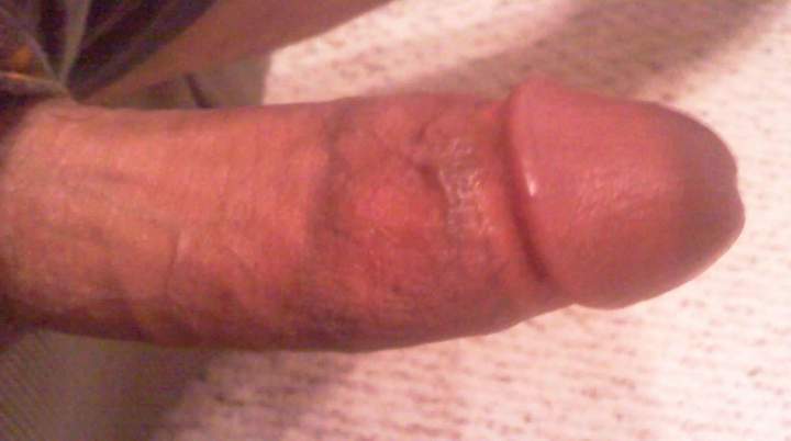 Swollen, again!