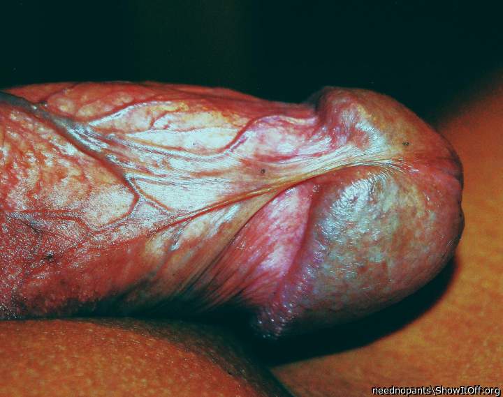 Photo of a purple headed monster from neednopants
