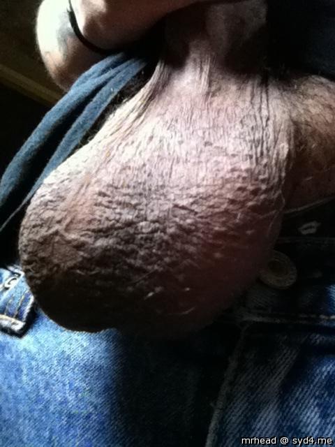 Testicles Photo from Mrhead