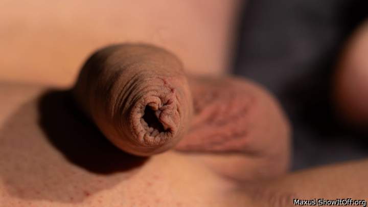 macro Foreskin