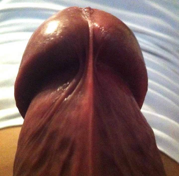 Head