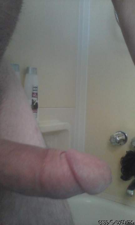 Photo of a penile from gapp