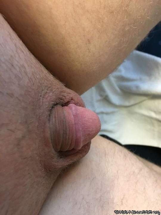 My Circumcised Dick-Do you like it?