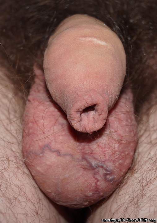 Photo of a cock from uncutguy84