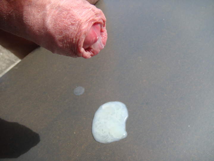 Photo of a penis from sivad666