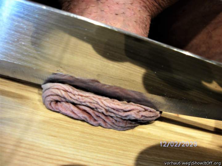 circumcision Beschneidung