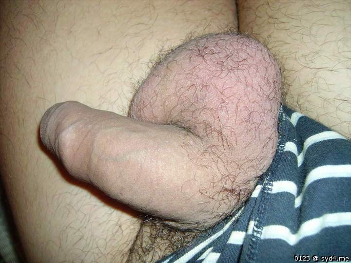 Photo of a short leg from 0123