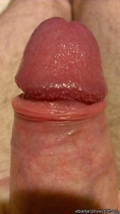 Photo of a wiener from vtbartje