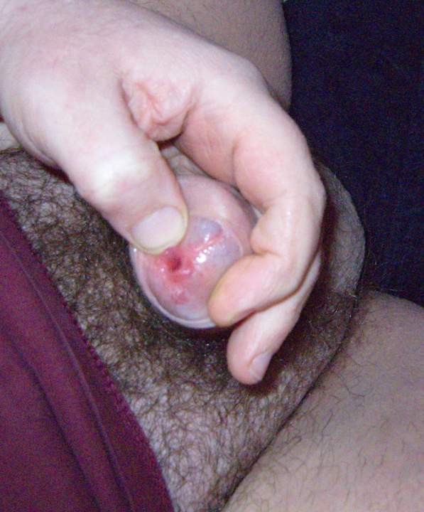 opening up for you